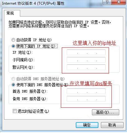 本地连接ip设置